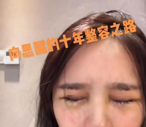 台州网红项思醒整容,台州网红的蜕变之旅