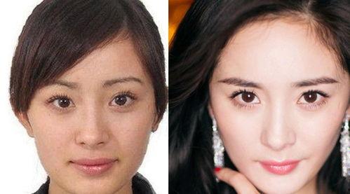 什么君的整容明星,整容明星的蜕变之路