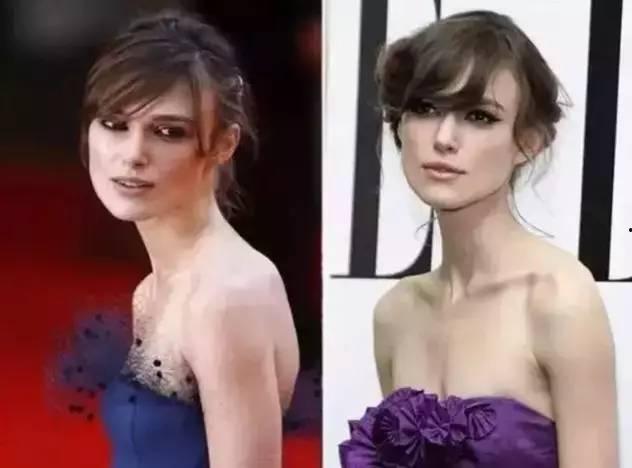 有富贵包的女明星,揭秘拥有“富贵包”的女明星们的独特魅力